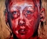 SUBJECT_GEFYRA_Trauma-Complex_web